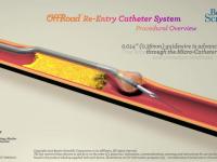 OffRoad Re-Entry Catheter System